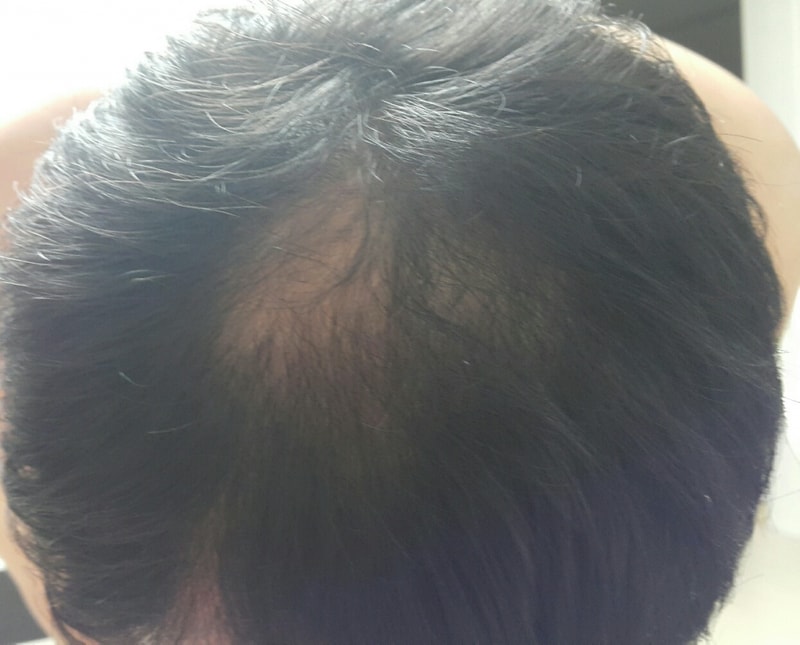 abote + midinoxil 100天后期