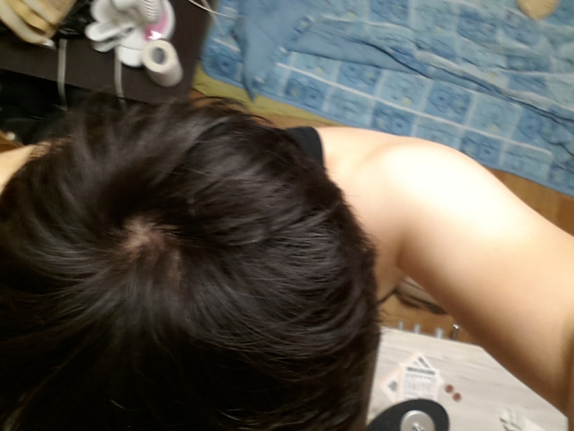 9월 30일 마이녹실 도포 후