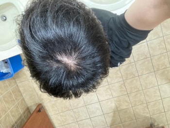 가르마 안한 현재 머리