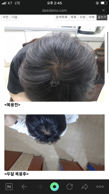 복용 전 두달 후