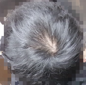 형광등 아래 2