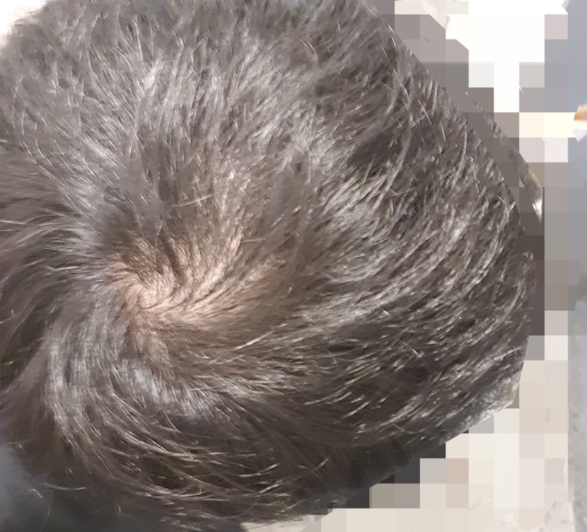 자연광?? 무서운 백열등 아래 중 하나