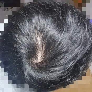 형광등 아래 3