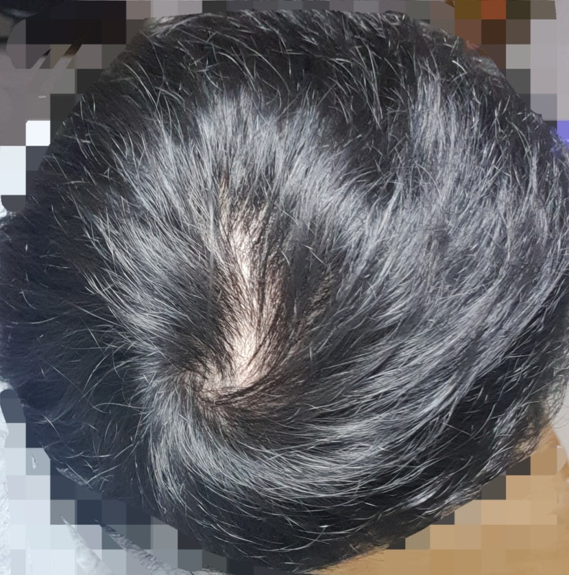 형광등 아래 3