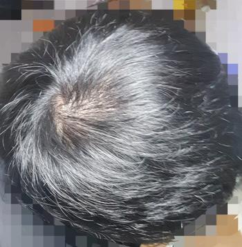 형광등 아래 1