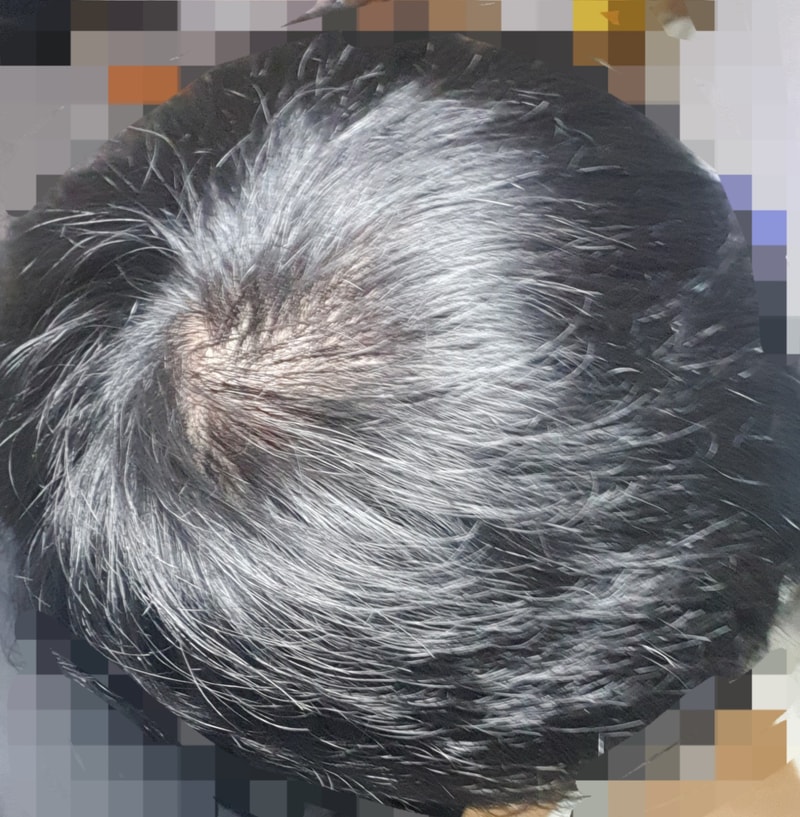 프페 7개월 / 미녹 2개월 기록용