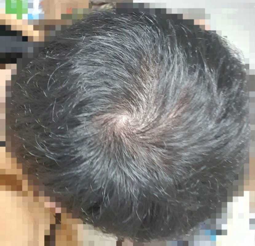 113일차 현재