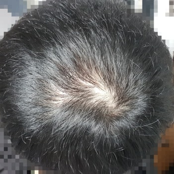 현재 빗질한 머리