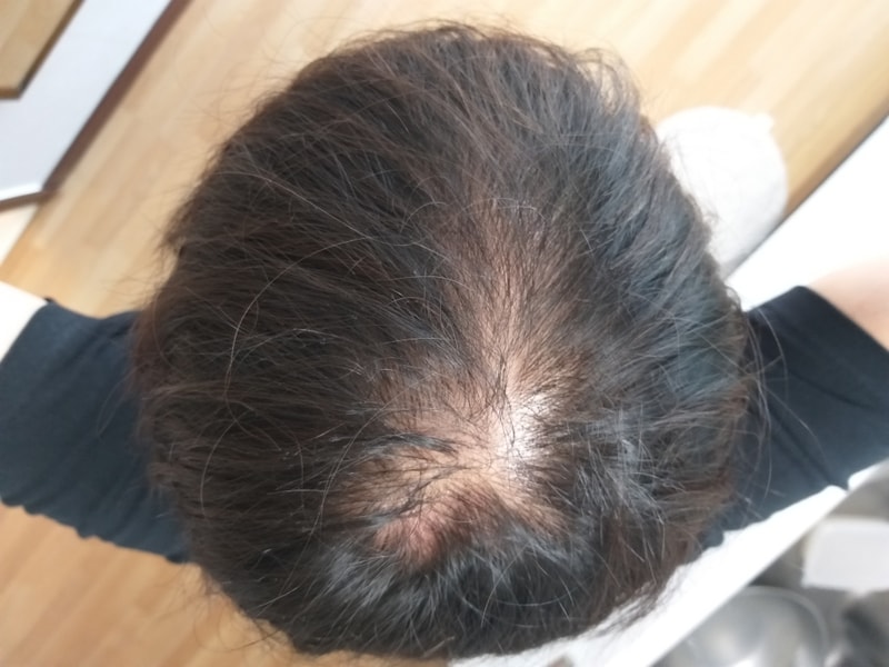 프페 미녹  후기 27일?차