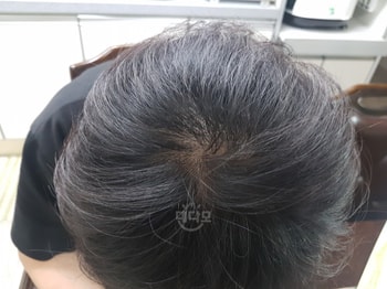 복용전