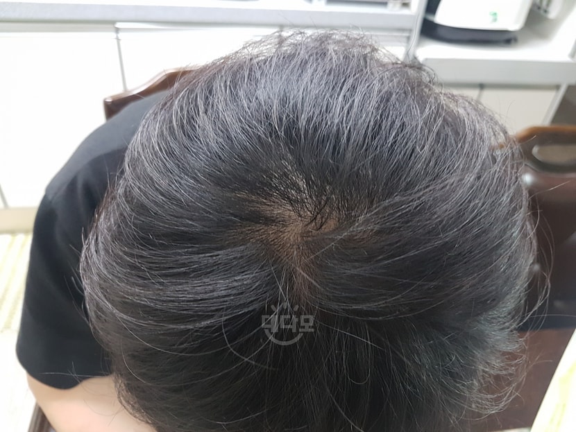 복용전