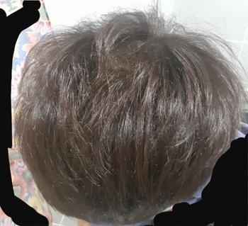 복용 111일차 사진 