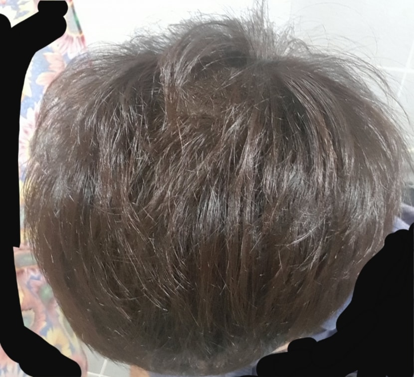 복용 111일차 사진 