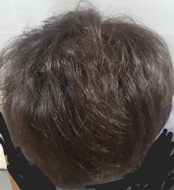 복용 111일차 사진 