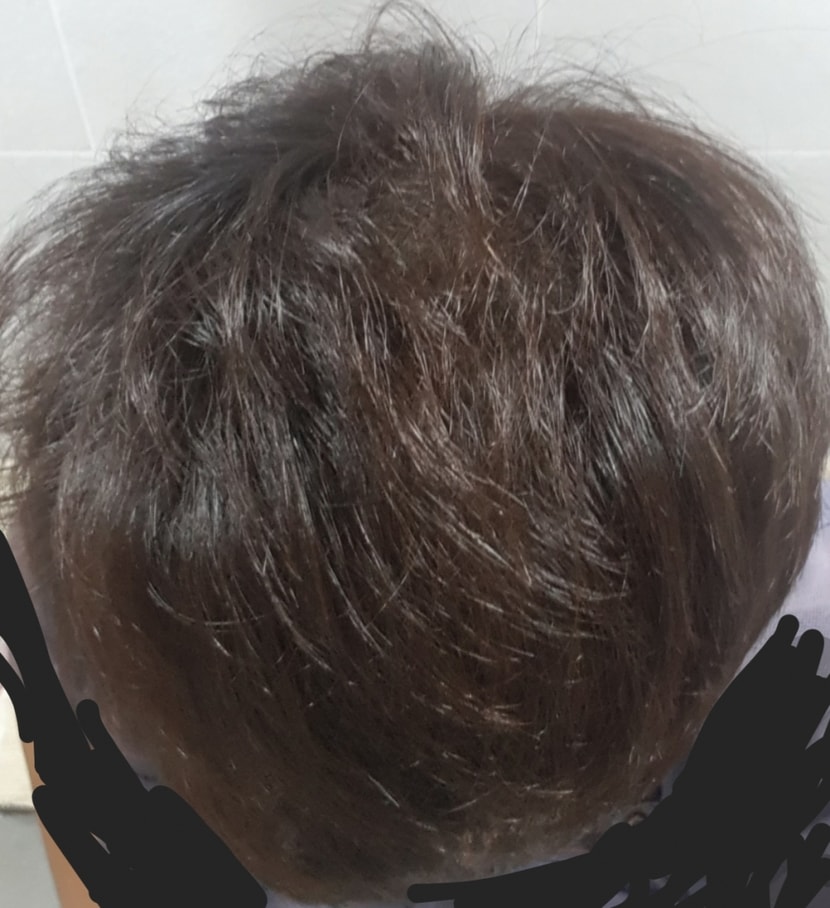 복용 111일차 사진 