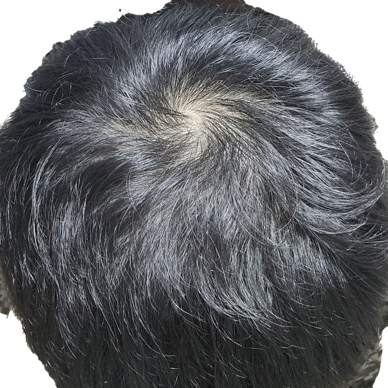 피나 20일 전후입니다