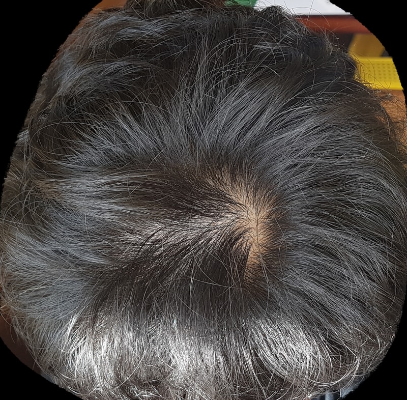 芬佩西亚八周后期