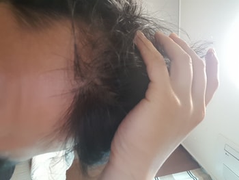 프페 미녹 4개월차