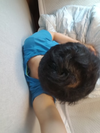 프페 6개월차 정수리