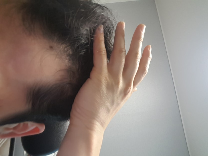 프페 미녹 4개월차