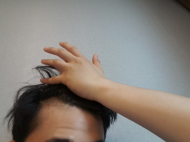프페 미녹 6개월차