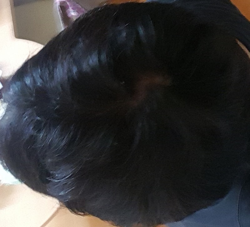 프페 7개월 1주차 리얼 솔직 후기!?(음슴체 주의)