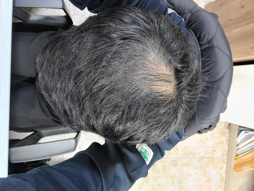 복용전