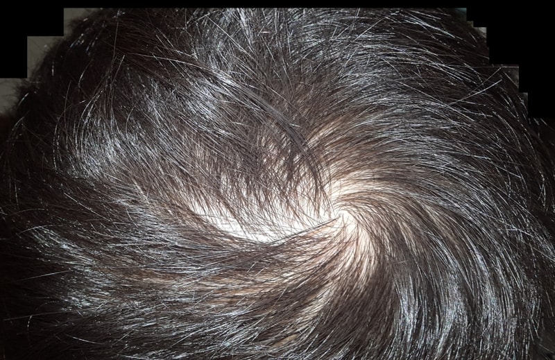 FFF+Minok两个月后记照片