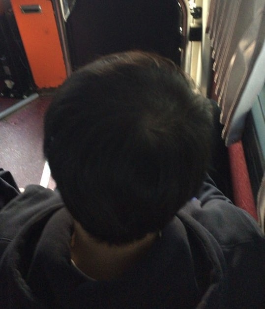 복용3개월 현재