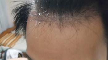 앞머리