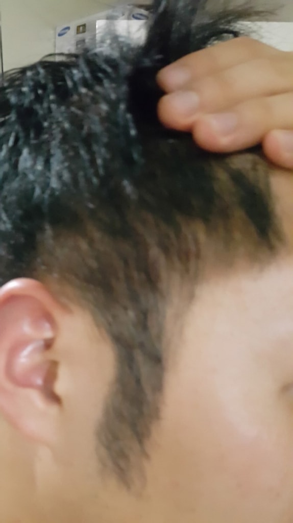 옆머리 1