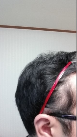 36일째 오른쪽엠자