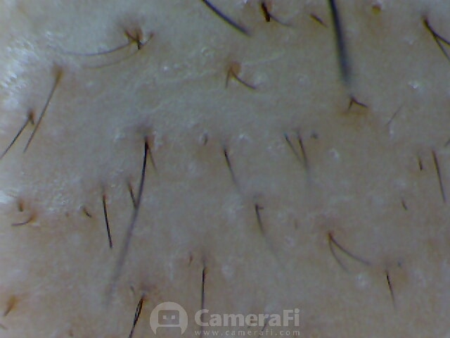 아보 1.5달후기 (2)