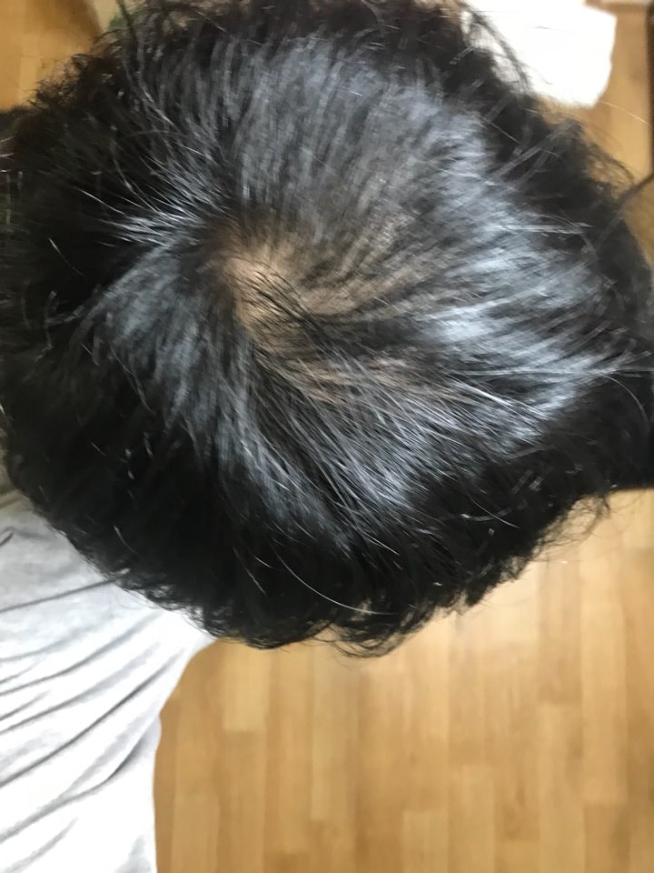 솔직히 나아진건 없음,.