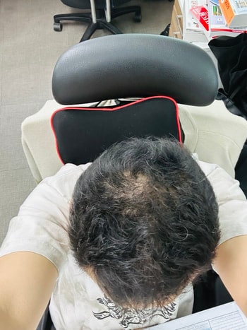 2024년 8월21일 약 100일째
