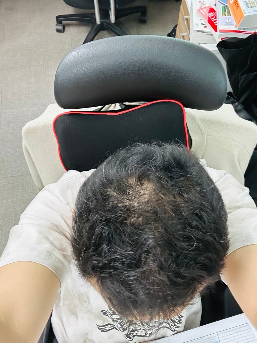2024년 8월21일 약 100일째