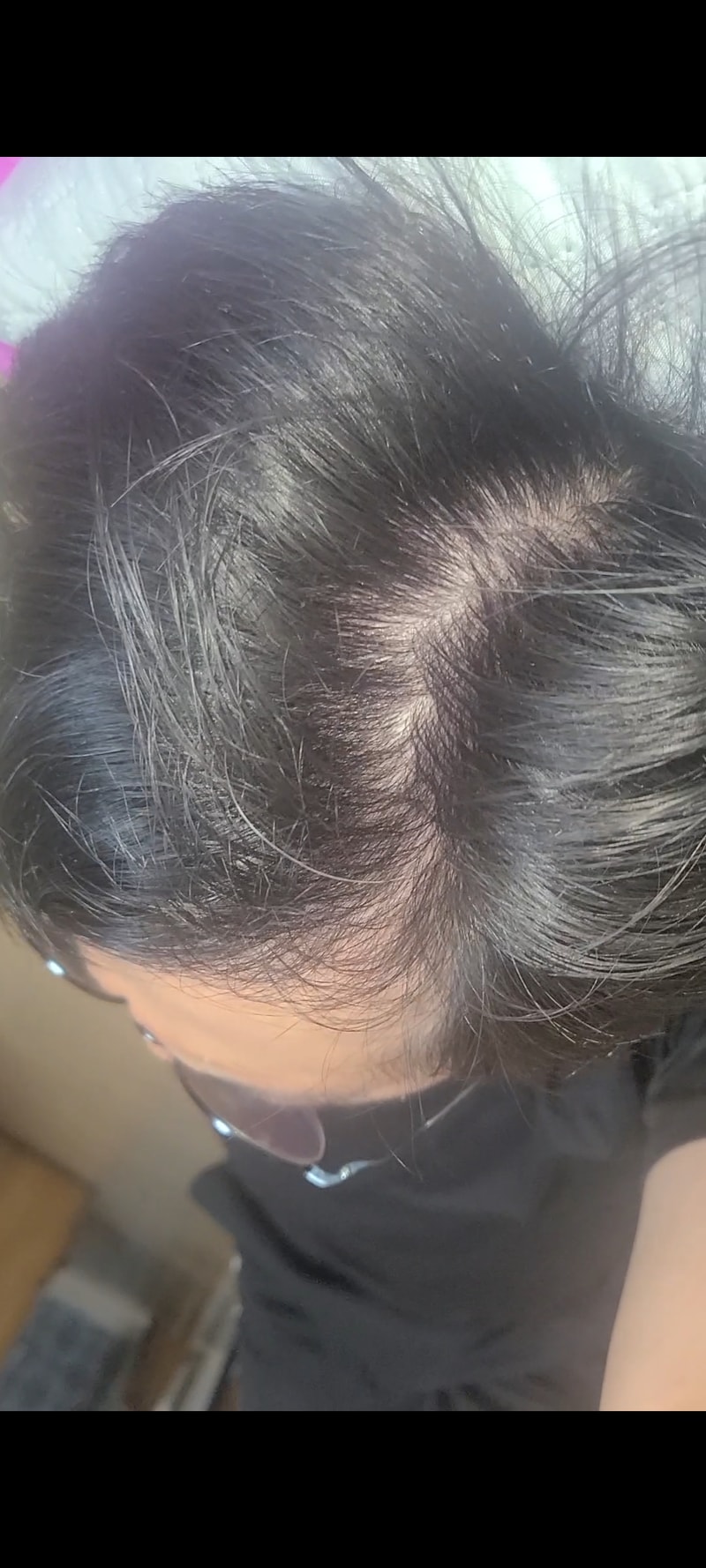 It's been 2 months since the M shape but it's still lagging
