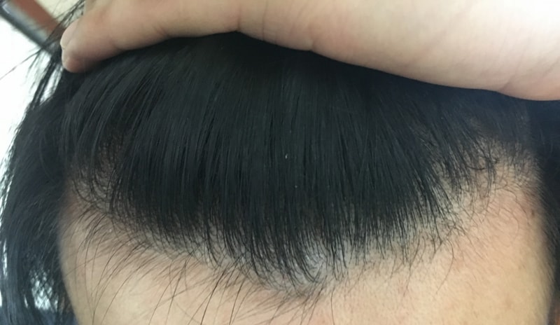 普费纳罗克两个月后记