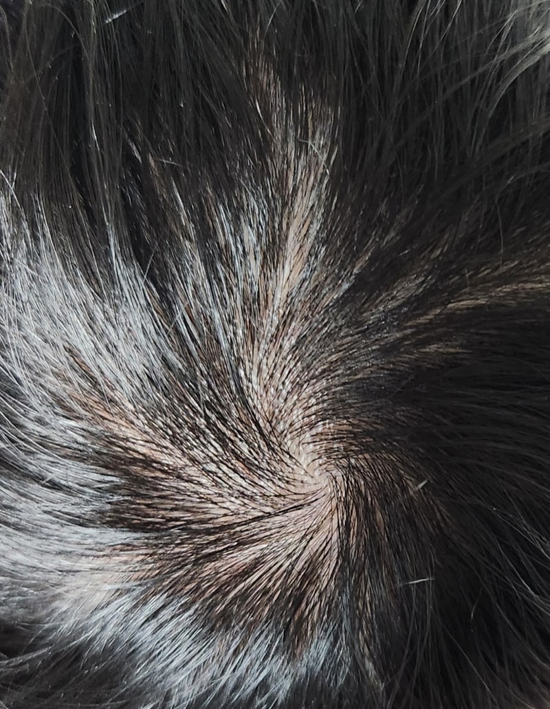 Maisia (Profesia Copy Drug) Day 2 of the lap bath. I'll update you whenever I see the progress in the middle.