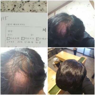 马山cb议员即将发表5个月后记