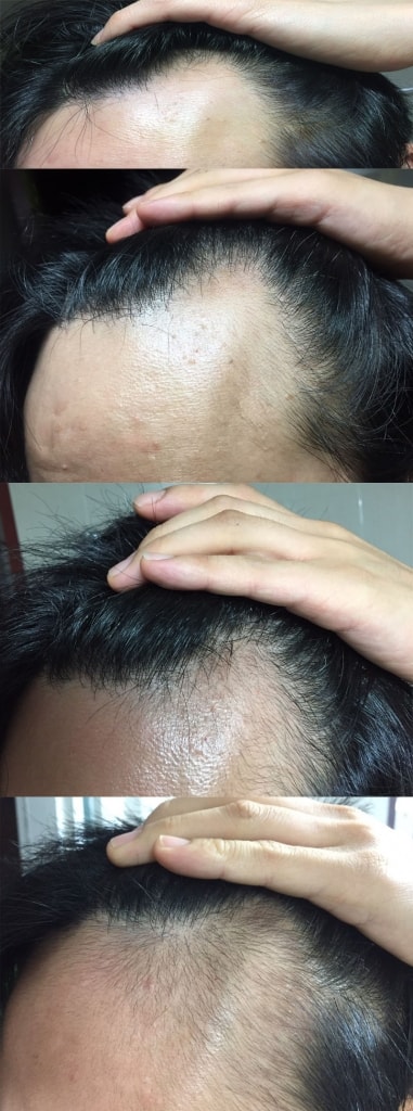 두타+커클미녹 거의 4개월 반