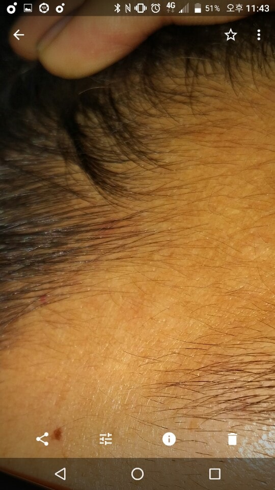 아보다트 + 커클랜드 75일째 후기