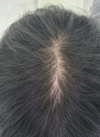 드디어 벗어났습니다!! 기뻐해주십쇼!! (인증 有)