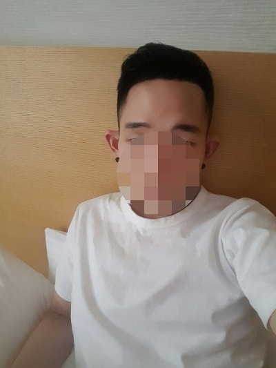 ONLY 커클랜드 미녹시딜 4개월차 확실히 효과 봤네요. [비포&애프터]