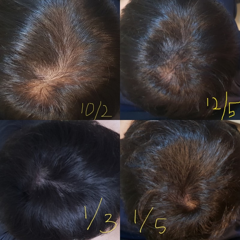 是普菲米诺生物素维生素第3个月的后期。