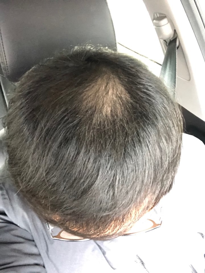 3개월후 사진