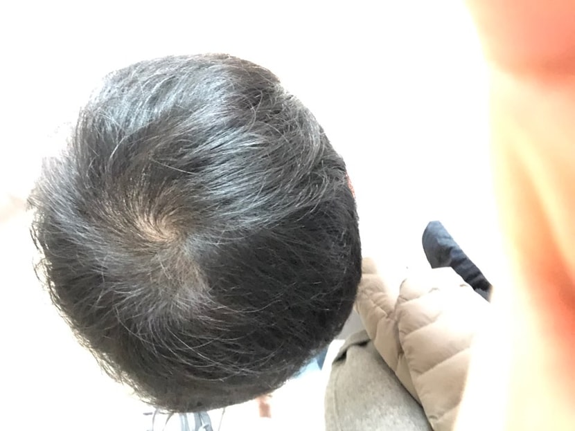 3개월 15일 후 사진 오늘