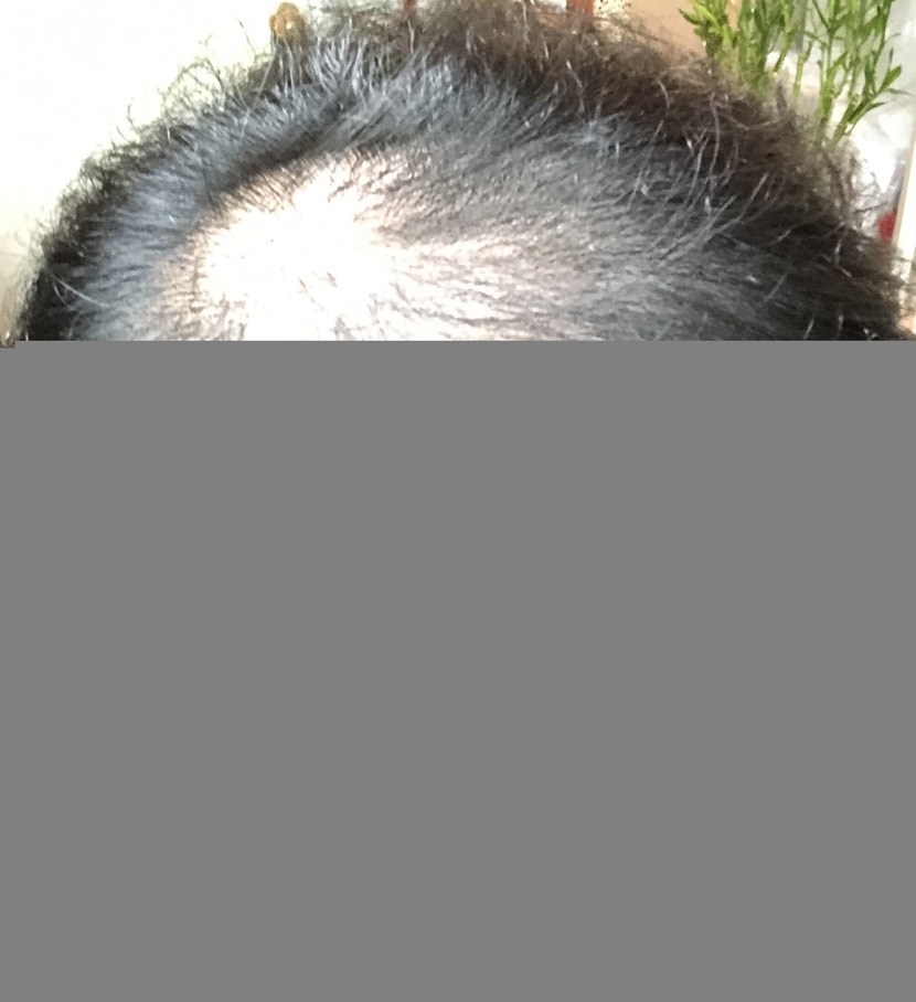 옛날 덮었을 때 사진입니다