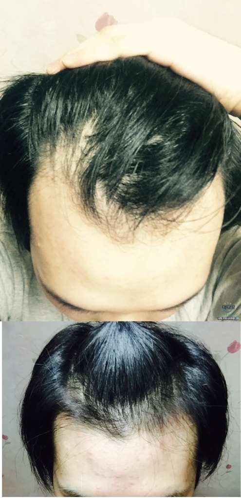 阿布扎特3个月左右和后期。