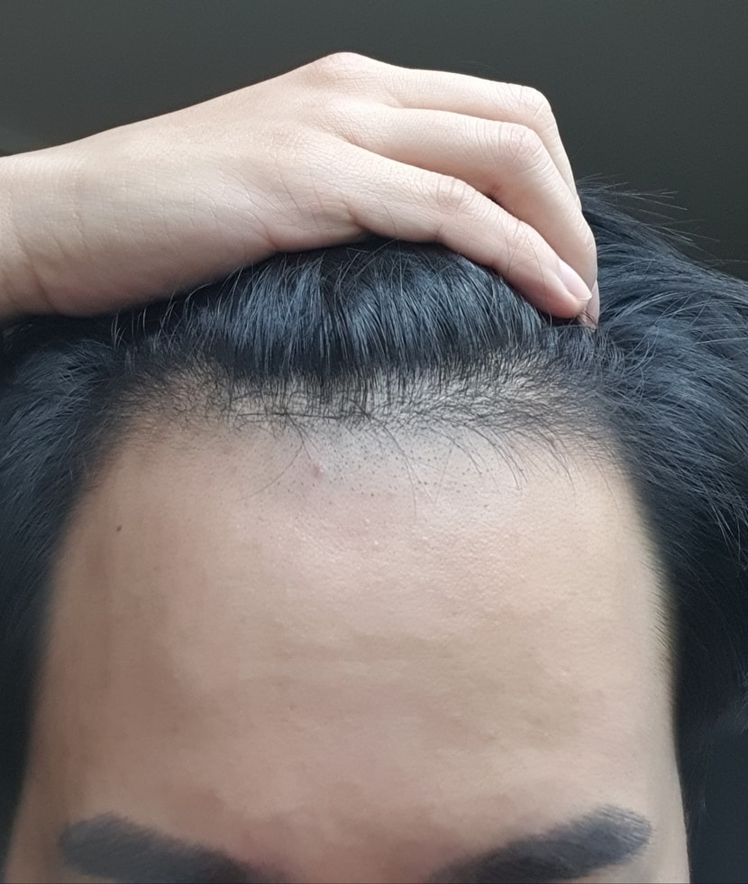 앞머리